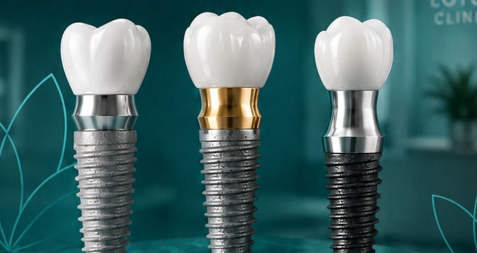 Implanturi dentare Straumann, Dentium si INNO la Clinica Lotus Navodari